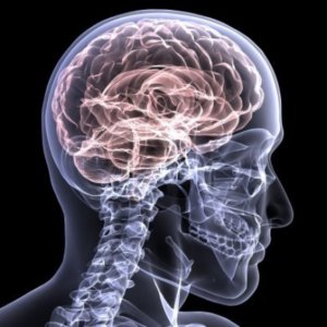 Traumatic Brain Injury
